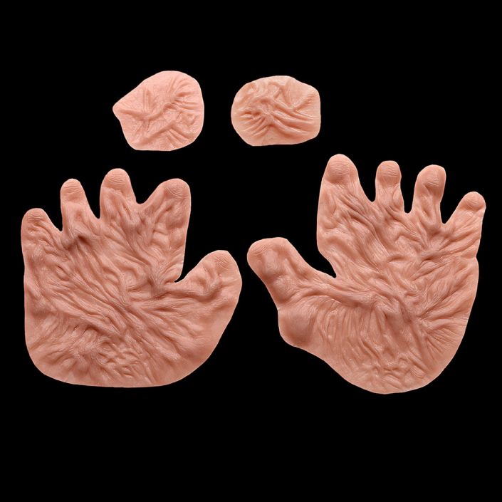 HN2 - Burned Hands