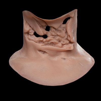 TH2 - Torn Throat Female