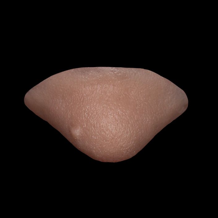 WC1 - Witch Chin
