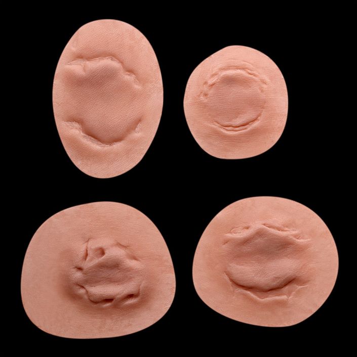 B1 - Set of Bite Wounds 3