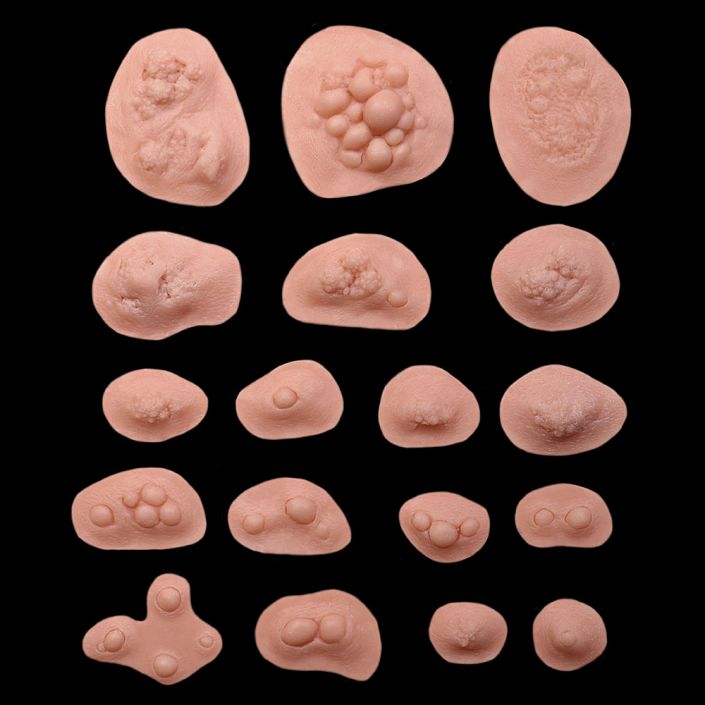 BS2 - Boil Set Small