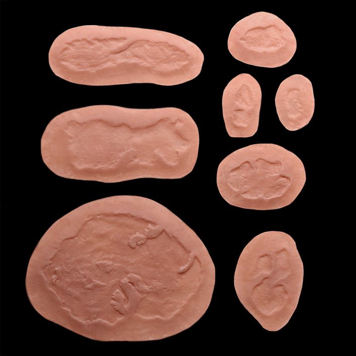 BR1 - Set of Fresh Burns