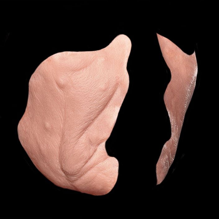 CK5 - Old Age Cheeks Male