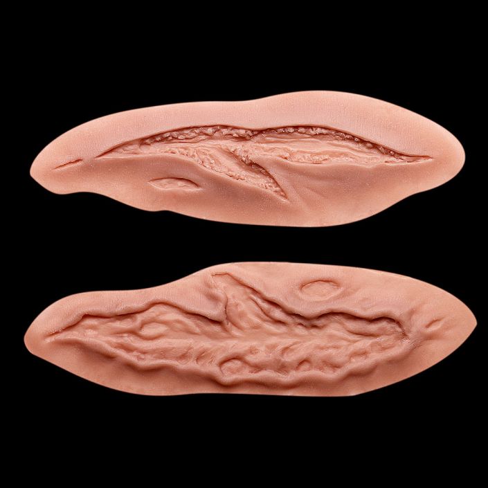 WD2 - Set of Wounds 2 Stages Large