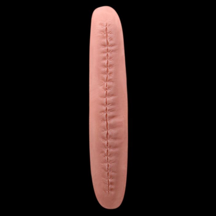 WD22 - Long Stitched Wound
