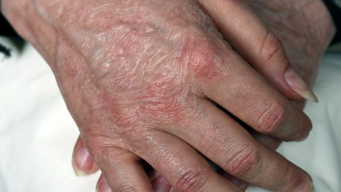 HN5 – Old Age Hands Small