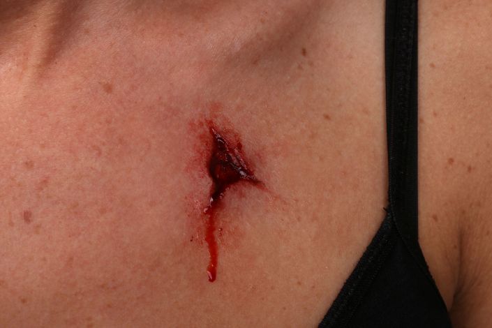 WD11 - Bullet Wounds Entry - Image 4