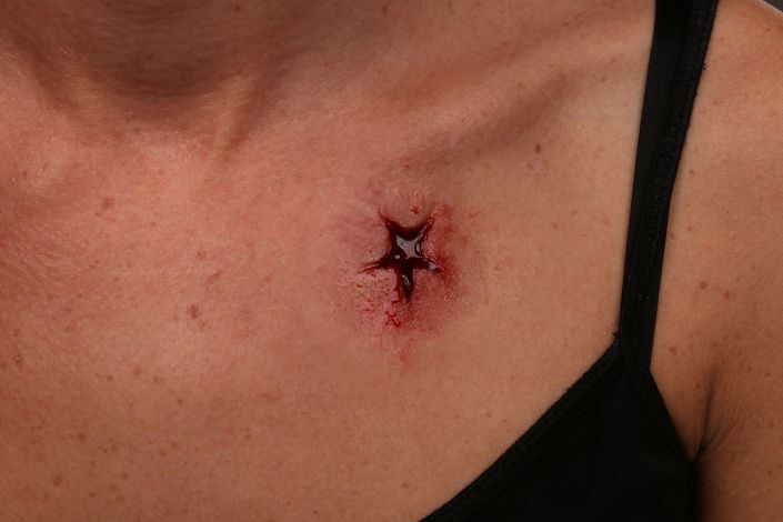 WD11 - Bullet Wounds Entry - Image 3