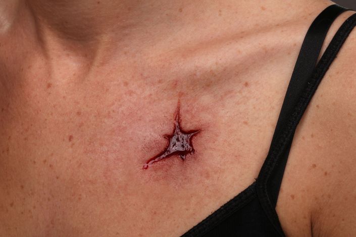 WD11 - Bullet Wounds Entry - Image 2