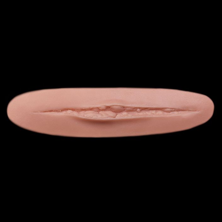 WD14 - Slice Wound Large
