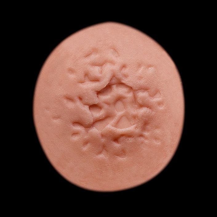 WD9 - Shotgun Wound