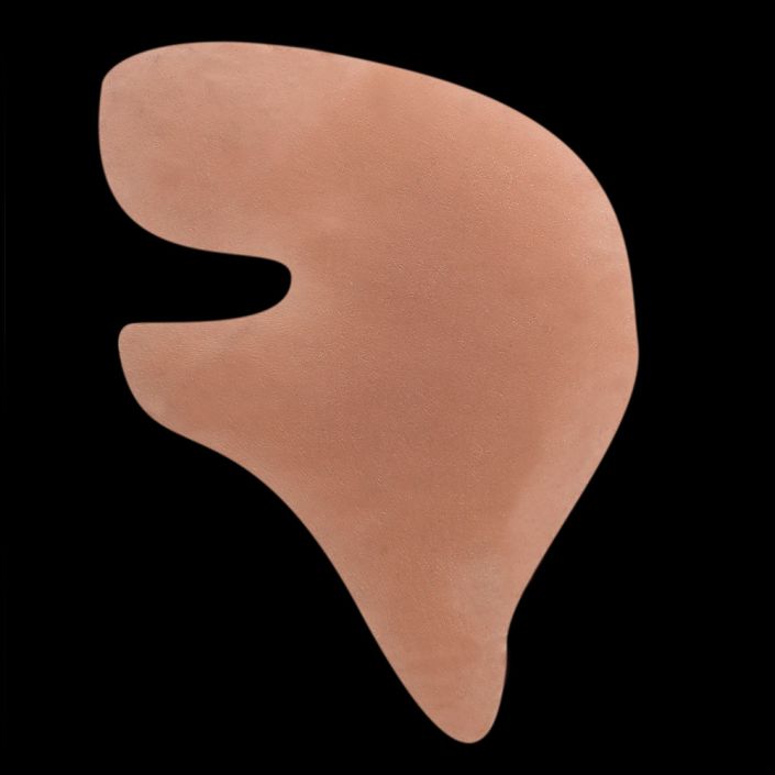 BC3 - Side of Head / Bald Patch
