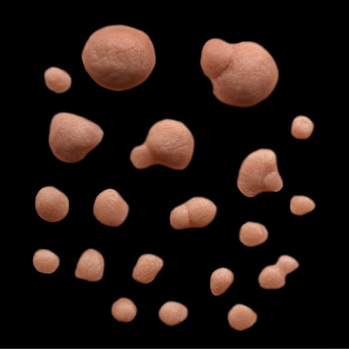 WR1 - Set of Small Warts 