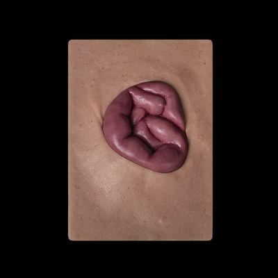 WD23 - Abdominal Wound